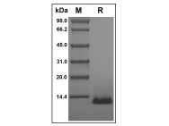Recombinant Human TSC-1 Protein(Active)