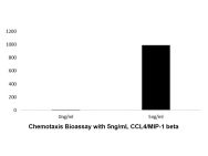 Recombinant Human CCL4/MIP-1 beta Protein(Active)