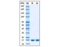 Recombinant Mouse IL-1 beta Protein(Active)